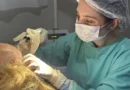 Referência em calvície, hospital do Paraná oferece tratamento gratuito pelo SUS
