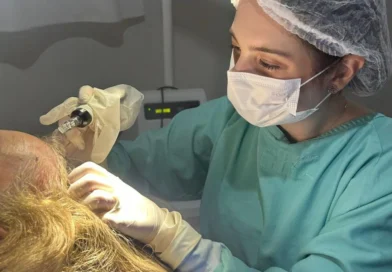 Referência em calvície, hospital do Paraná oferece tratamento gratuito pelo SUS