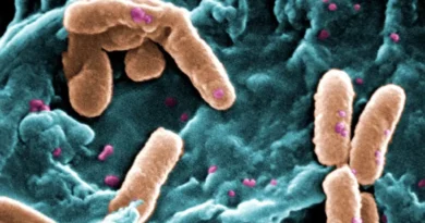 Pseudomonas aeruginosa em produtos Ypê: saiba mais sobre a bactéria