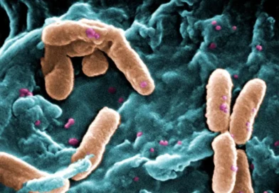 Pseudomonas aeruginosa em produtos Ypê: saiba mais sobre a bactéria